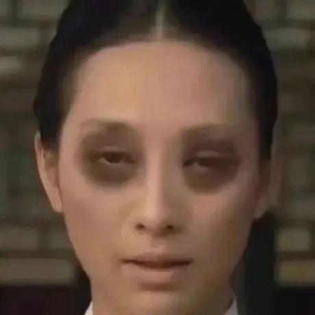 美女严重眼圈
