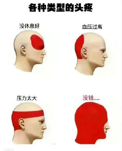 各种类型的头疼...