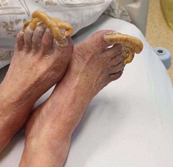 迷人的长趾甲