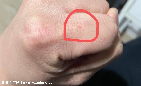 10种图片猫抓破皮不需要打针