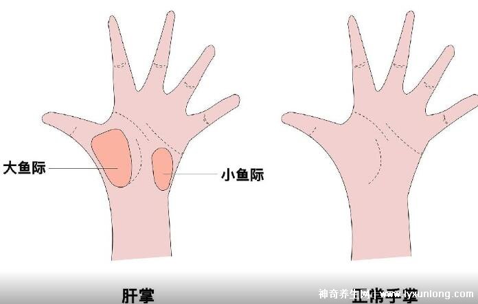 肝掌图片高清图片
