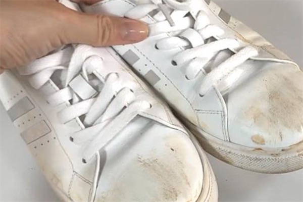 小白鞋变黄怎么办