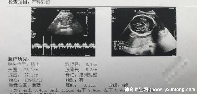 b超有两点基本是男孩