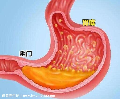 胃在什么位置图片