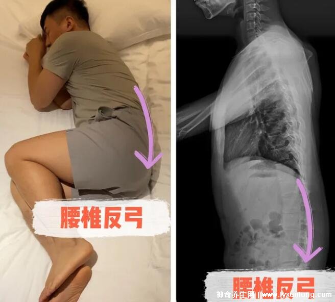 腰椎最怕三种睡姿图片