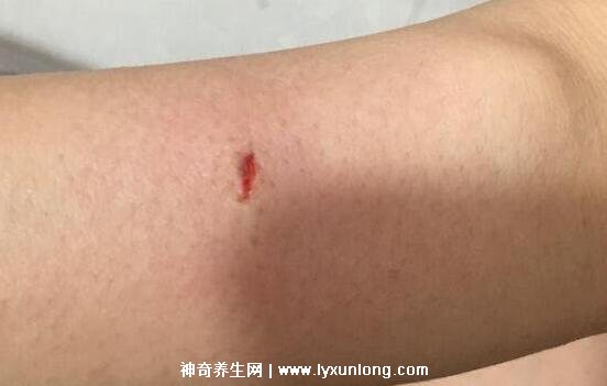 10种图片猫抓破皮不需要打针