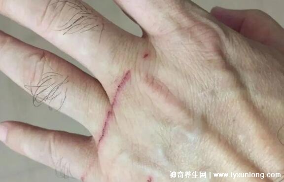 猫抓出血狂犬病几乎为0