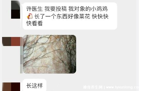 男性早期图片尖湿锐尤,下面长尖尖的各种形态症状(有图慎入)