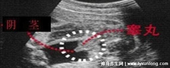 b超有两点基本是男孩