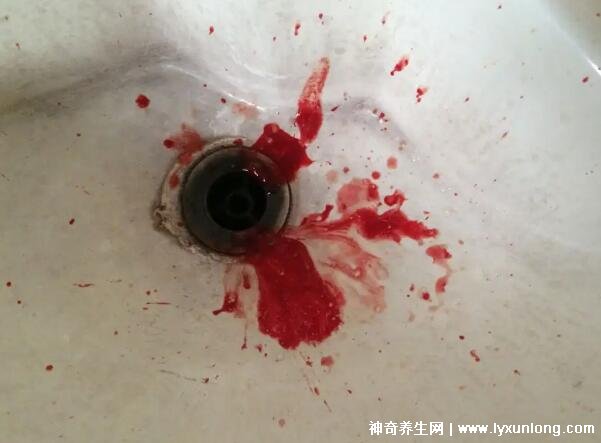 肺癌晚期最怕三个征兆