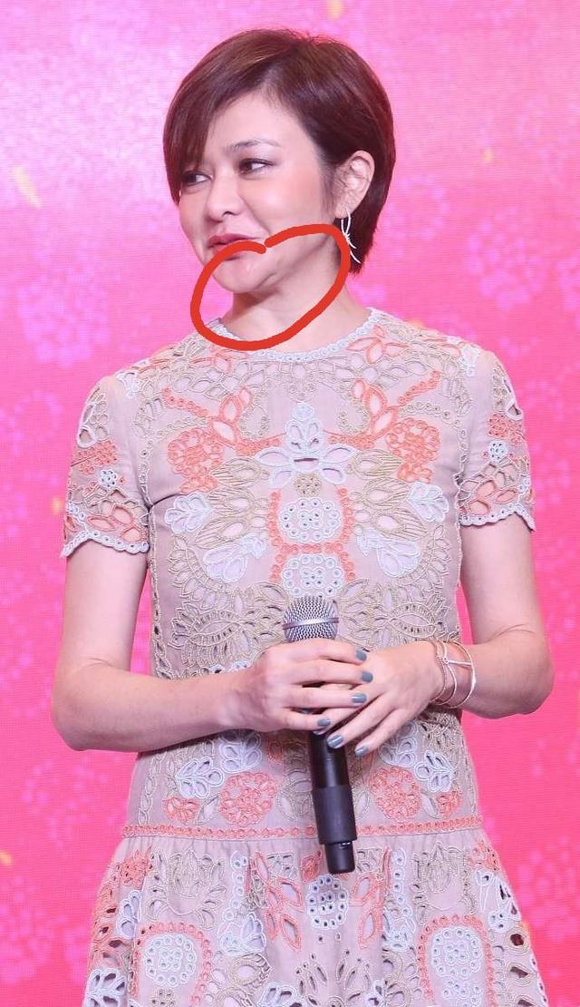 关之琳无美颜的脸太真实，正面看精致侧面却显松弛下巴，笑容太僵