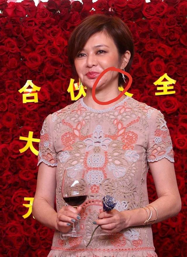 关之琳无美颜的脸太真实，正面看精致侧面却显松弛下巴，笑容太僵