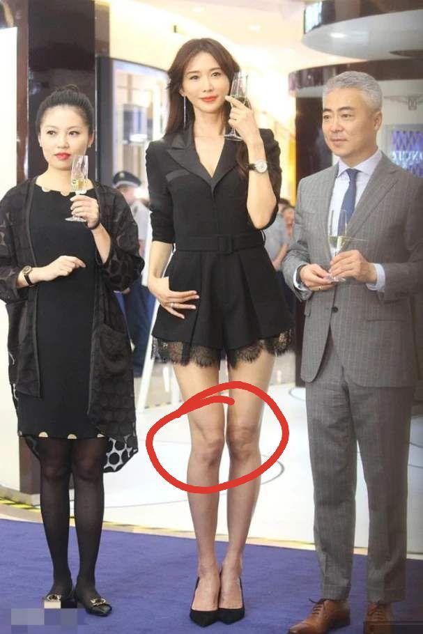 吴昕参加姐姐后脱胎换骨，穿露脐装搭长袜，暴露膝盖内翻勒出赘肉